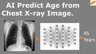 Predict Age from Chest X-ray Image. Deep Learning + Regression  Kaggle notebook demo