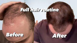 The Hair routine that saved my hair… Reversing hair loss EP 2