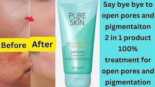 Oriflame Pure Skin clay mask  100% solution for open pores and pigmentation @DollysDailyVibe