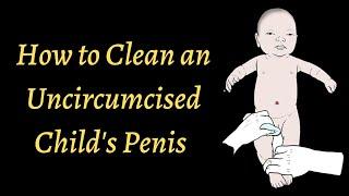 How to Clean an Uncircumcised Childs Penis