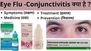 Eye flu Conjunctivitis Types Treatment Ilaj Medicine Eye drop  Kya Hai