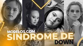 Personalidades que  Fazem História - Modelos com Síndrome de Down