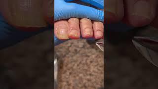 Satisfying pedicure video #pedicure #toenails
