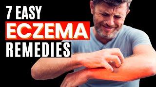 Try these 7 Best Natural Remedies for Eczema Atopic Dermatitis