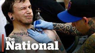 Tattoo particles migrating to lymph nodes