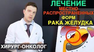 Рак желудка - лечение местно  распространенных форм