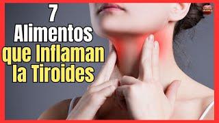  7 FOODS THAT INFLAMATE THE THYROID  give HYPOTHYROIDISM