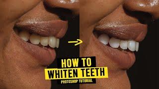HOW to WHITEN TEETH and EYES in Photoshop  Teeth & Eyes Retouching Tutorial