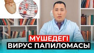 ВПЧ папилома ауруы Жыныстық қатынас кезінде жұқпалы ма?