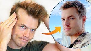 How I Stopped My Receding Hairline Mens Hair Loss Guide