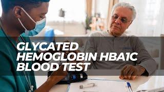 Glycated Hemoglobin HbA1c Blood Test in Diabetic Patients  A1c Level Diabetes Mellitus Type 2