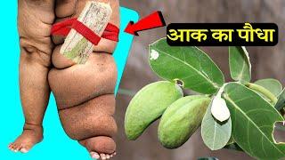 फीलपांव फाइलेरिया .... हर बीमारी का काल है आक का पौधा  Calotropis Gigantea मदार के फायदे और पहचान