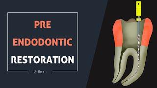 Pre Endodontic Restoration