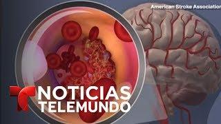 Varias maneras de prevenir un derrame cerebral  Noticiero  Noticias Telemundo