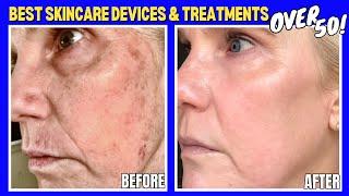 Best Skincare Treatments to Transform Mature Skin Top 3 Devices & Top 3 In-Office Treatments