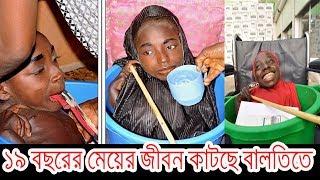 ১৯ বছরের মেয়ের বালতিতেই কাটছে জীবন -Girl With Half Body  Carried In A Bowl - Rahma Haruna