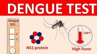 Dengue - Symptoms transmission and diagnosis