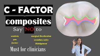 C Factor in dental composites