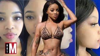Faith Nketsi Body Transformation Journey  Before And After Surgery