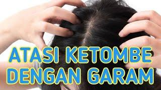 Cara Mengatasi Ketombe dengan Garam