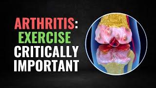 Heres Why Exercise is CRITICAL for Knee Arthritis