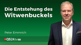 Wie Stresshormone einen Witwenbuckel auslösen  Facharzt Peter Emmrich  QS24 Gesundheitsfernsehen