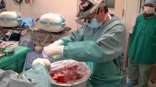 Groundbreaking Liver Surgery