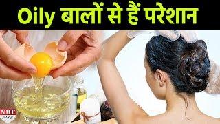 Learn How To Get Rid Of Oily Hair & Scalp Naturally