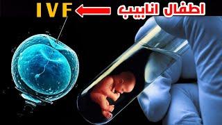 يعني اية اطفال انابيب؟ _ The difference between IVF and ICSI