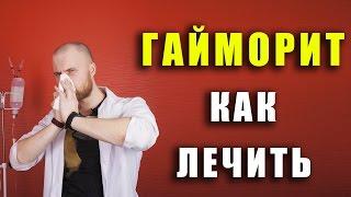 Гайморит  как лечить в гайморит домашних условиях  лечение без проколов  симптомы гайморита 