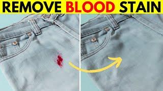 How to Remove Old Dried Blood Stains from Jeans