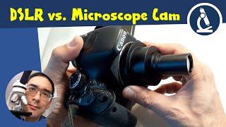  Usability considerations of microscope cameras DSLR vs dedicated cameras  Amateur Microscopy