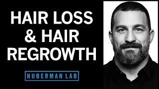 The Science of Healthy Hair Hair Loss and How to Regrow Hair  Huberman Lab Podcast