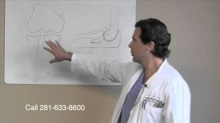 Posterolateral Elbow Instability - Orthopedic Surgeon Sugar Land Houston