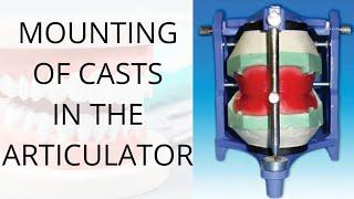 Mounting of casts in the articulator  Preclinical Prosthodontics