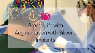 Breast Lift with Augmentation using Silicone Implants  Cosmetic Surgery Affiliates