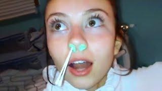 WAX STUCK In Her NOSE  FUNNY FAILS