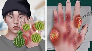 ASMR Animation Remove cactus spines from Gdragons hand  WOW Brain Satisfyingvideo