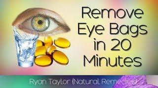 How To Remove Eye Bags 20 Minute Natural Remedies