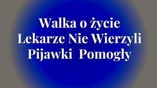 Historia Mariusza... Telefon o 1ej rano Stan Krytyczny - Pijawki Pomogły