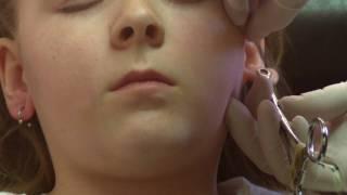 Sunnys needle ear piercing HD