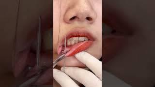 lip piercing #lip #lippiercing #piercing #piercings #piercingvideo #piercingsoftiktok #piercingtok