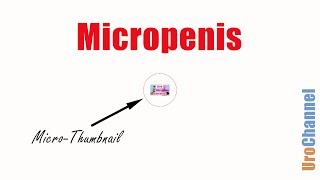 Stop Micropenis Concerns  UroChannel