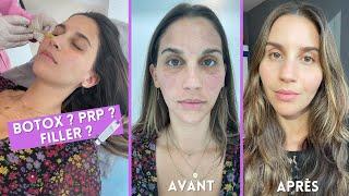 Comment ralentir le vieillissement de la peau après 30 ansBotox Filler PRP…