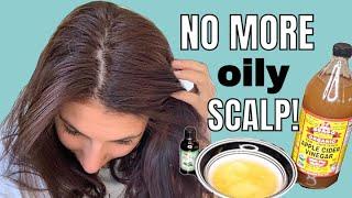 LIFE CHANGING DIY Hair mask for OILY HAIR  NO MORE OILY SCALP