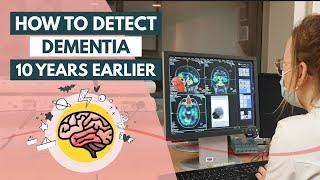 How to diagnose dementia 10 years earlier  Day of Science 2022