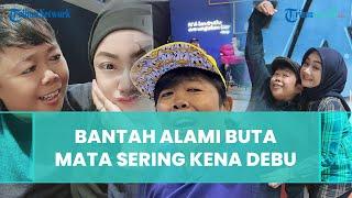 Disebut Alami Kebutaan Komedian Adul Beri Bantahan Sebut Kondisi Matanya Sering Terkena Debu