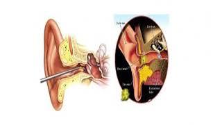 Hearing Problems What You Need to Know