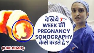 देखिये 7th Weeks में आपका Baby कैसे दिखता है ?  Sonography Week By Week Pregnancy  Dr Asha Gavade