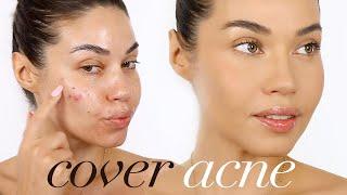 HOW TO COVER ACNE with MAKEUP  Eman